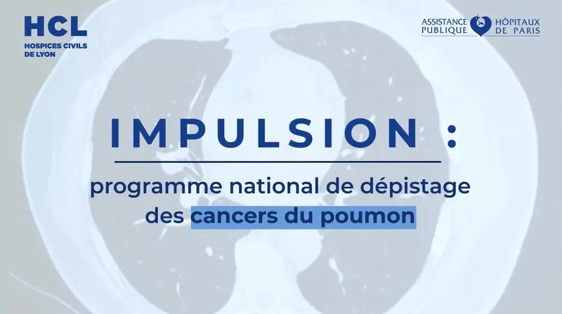 Image d'illustration de la vidéo